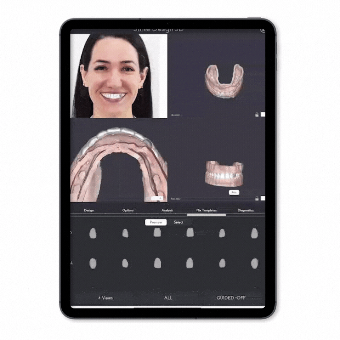 Asiga Box images (Website) (2)