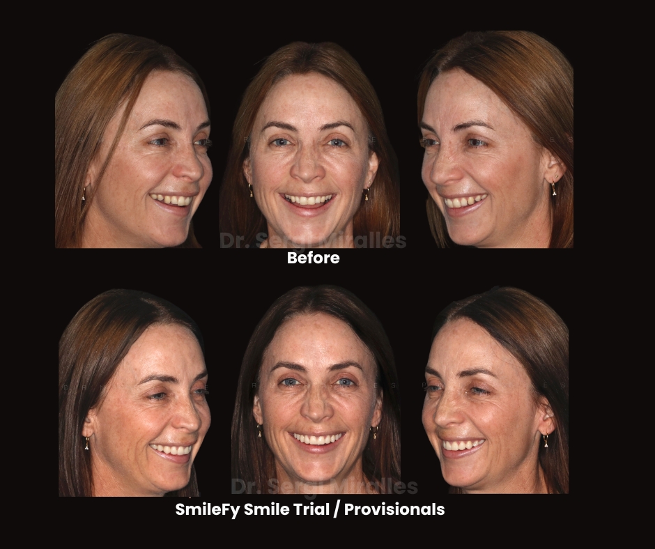 Dr. Sergi Miralles SmileFy 15