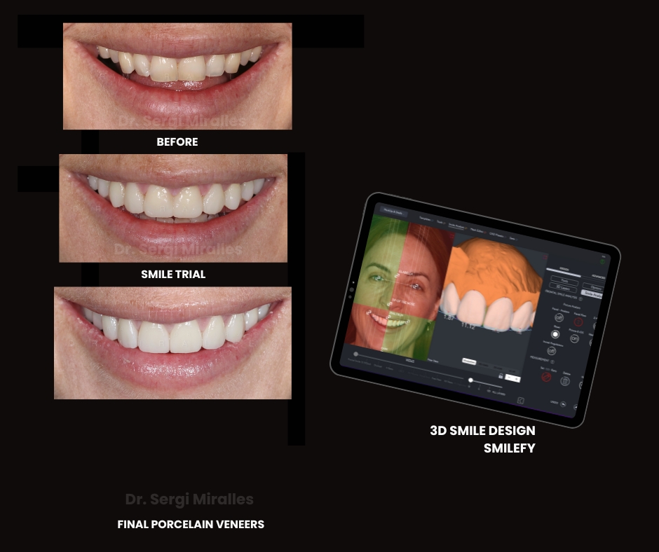 Dr. Sergi Miralles SmileFy (3)