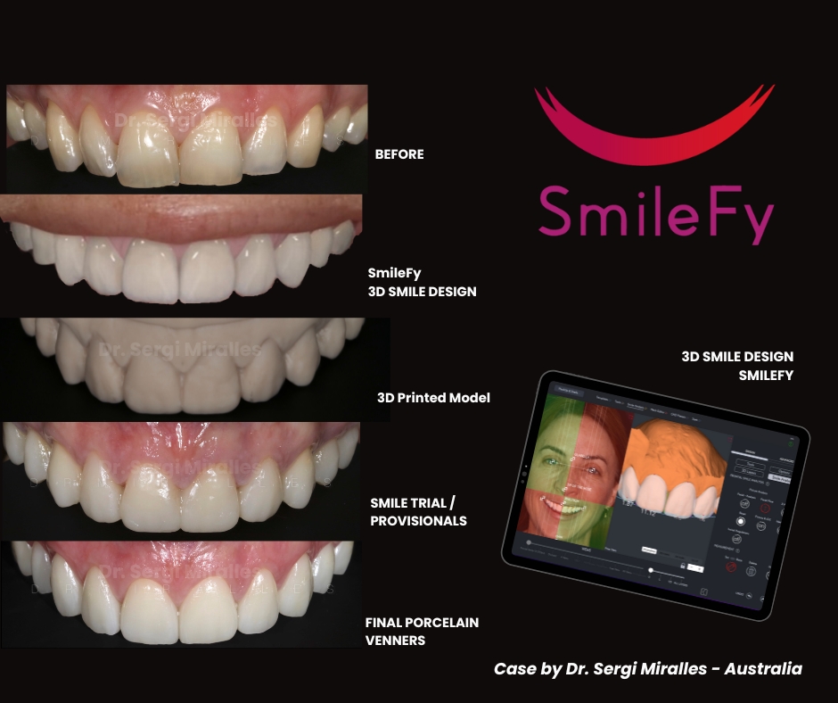 Dr. Sergi Miralles SmileFy (4)